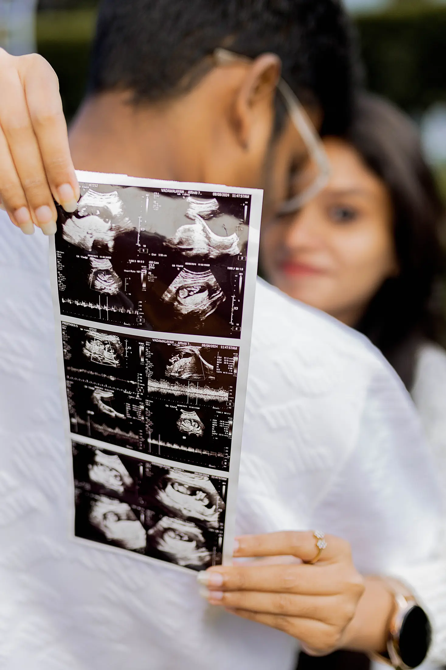 Baby Shower in Erode | Kutti Story Photography